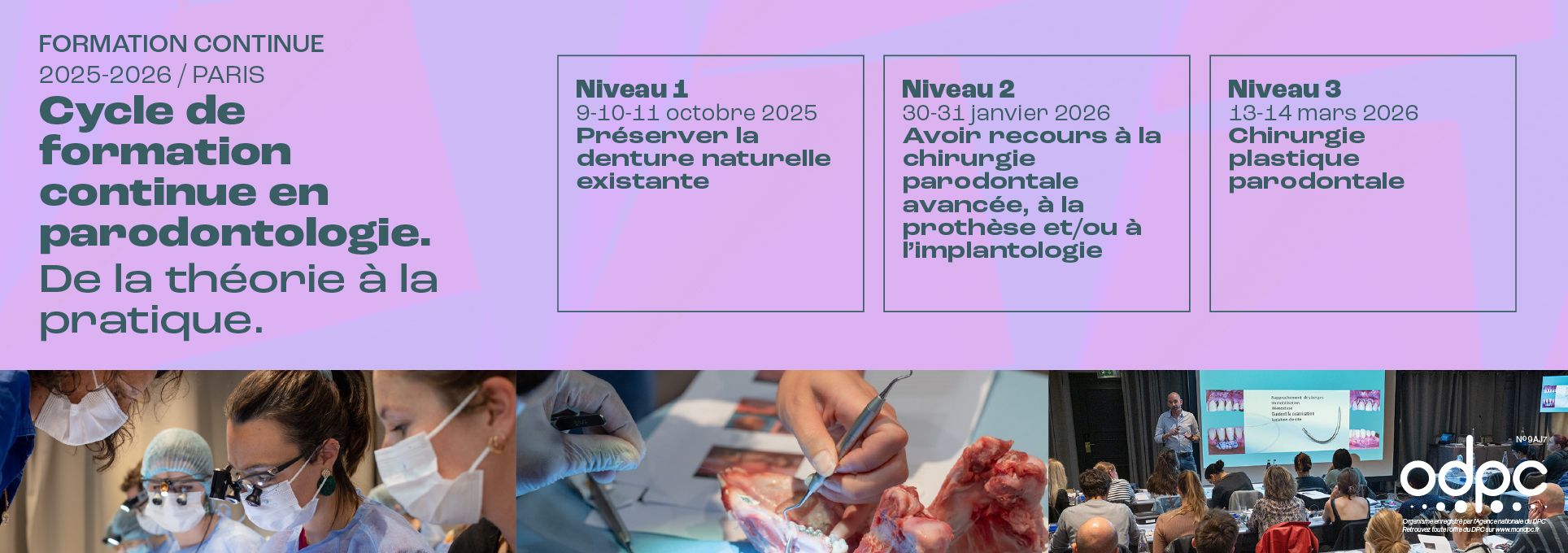 Cycle de Parodontologie SFPIO