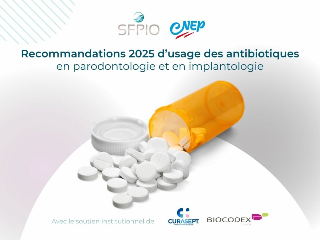 L’usage des antibiotiques en parodontologie : La SFPIO et le CNEP partagent leurs recommandations