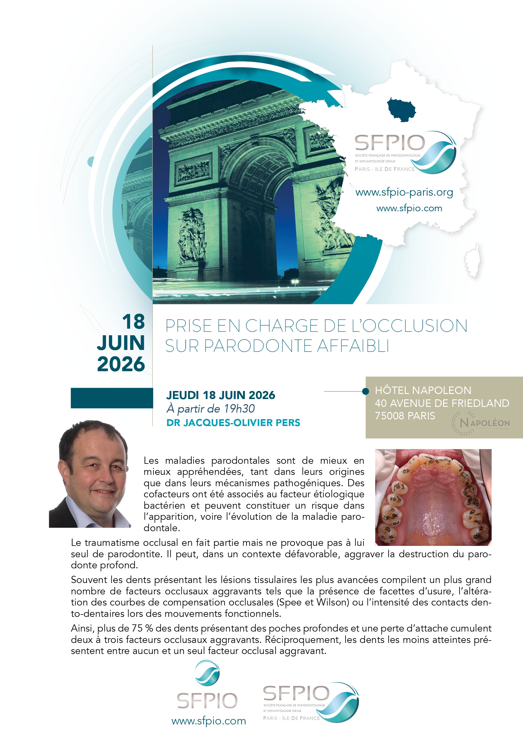 Prise en charge de l’occlusion sur parodonte affaibli