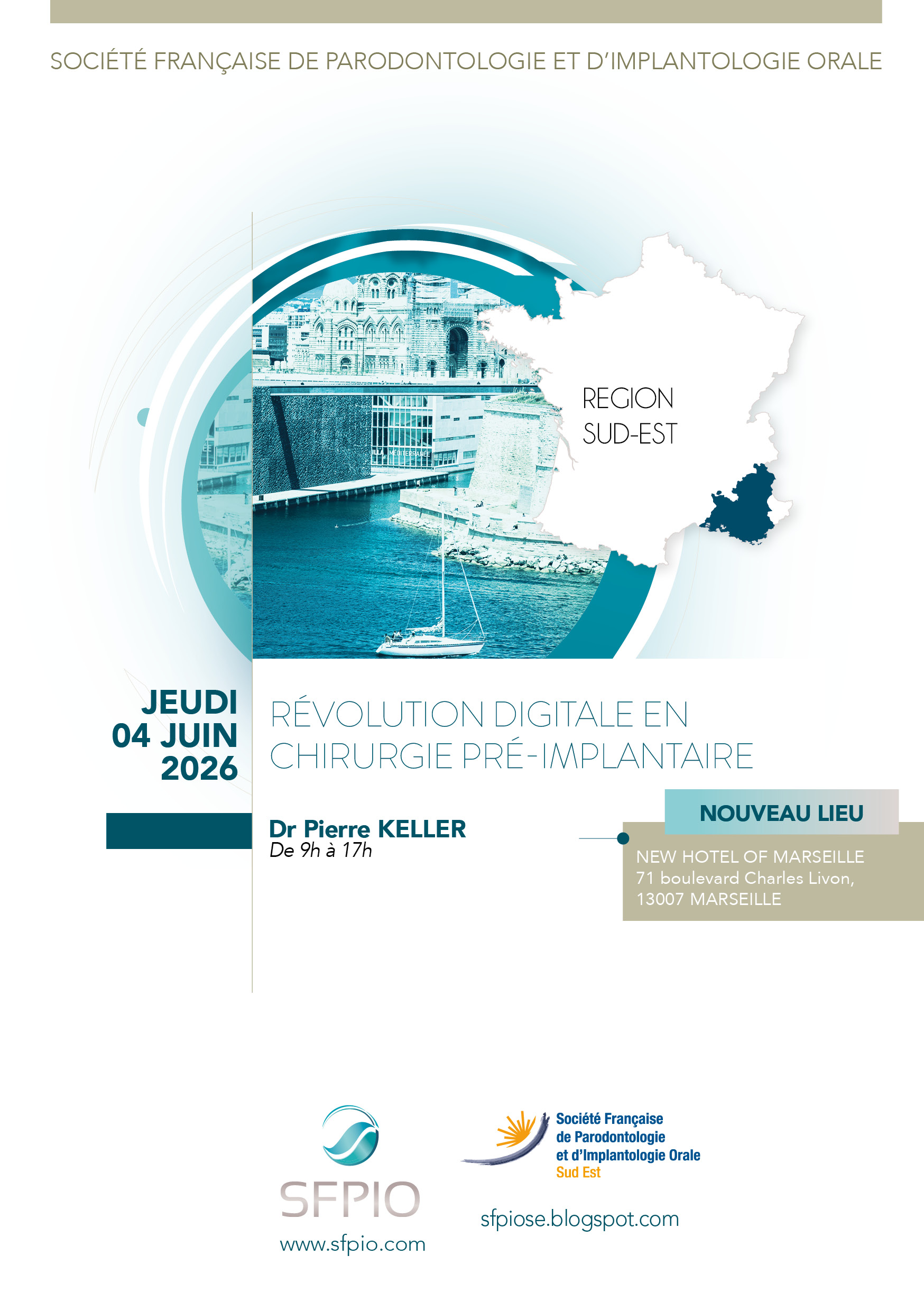 Révolution digitale en chirurgie  pré-implantaire